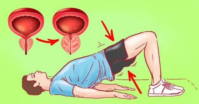 prostatitis